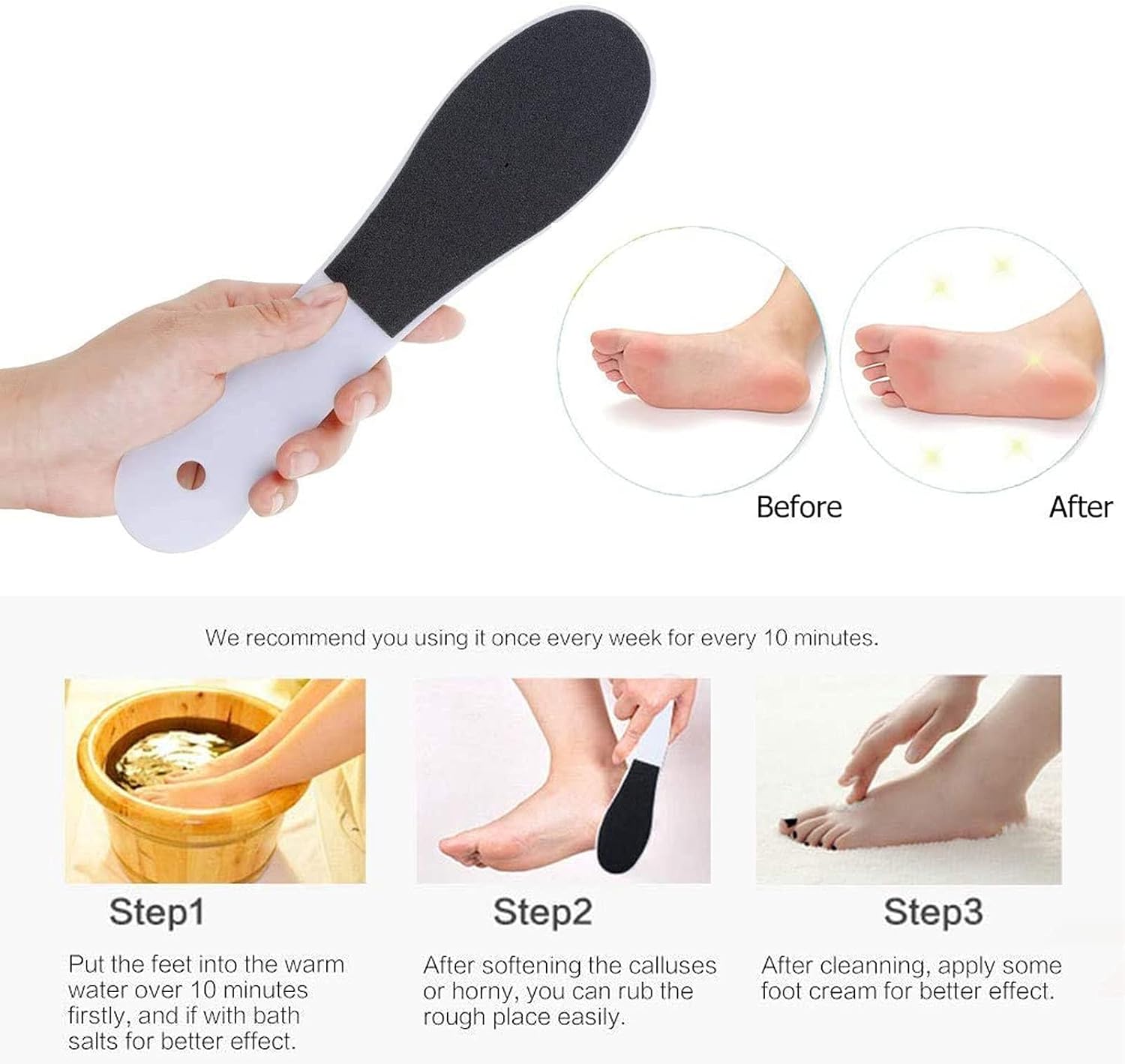 Buy SONGQEE Foot File Hard Skin Remover, DoubleSided Foot Files