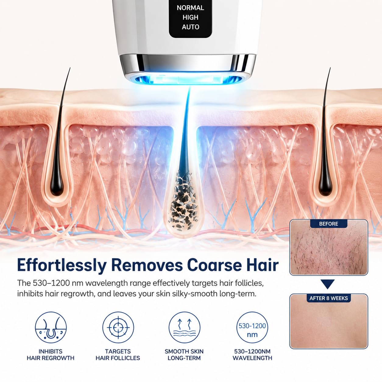 IPL Epilierer damen, Laser haarentfernung mit Kühlfunktion, MAX 21J, 999,999 Lichtimpulse, Schmerzfreie IPL Haarentfernungsgerät für Frauen, Männer, Achseln, Bikini, Beine, Körper