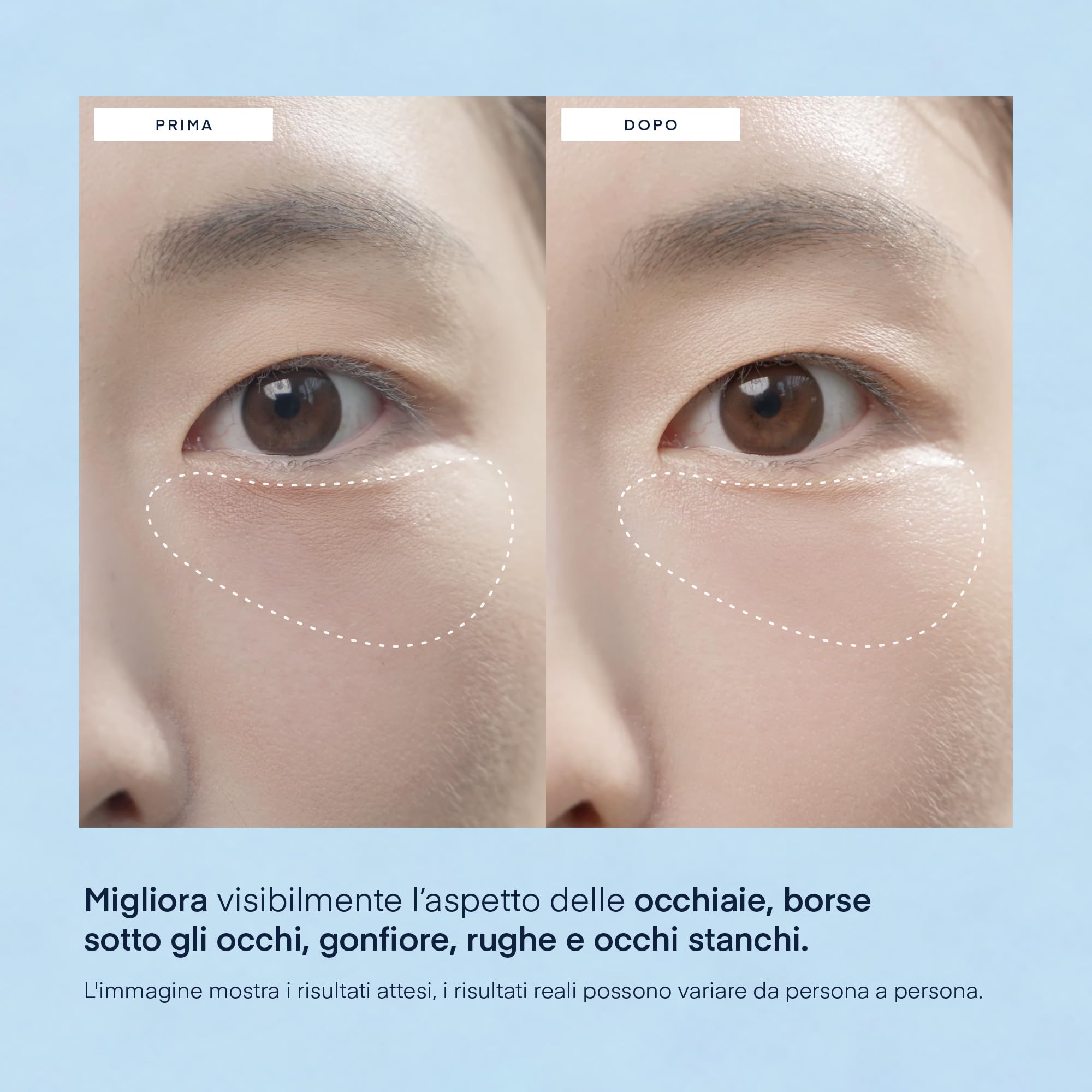 Patch Occhi per Occhiaie Skincare Coreana: Maschera Contorno Occhi con Caffeina e Acido Ialuronico - Sgonfia Borse & Antirughe 30 Paia - Vegano, Testato su Pelle Sensibile - Korean Under Eye Patches