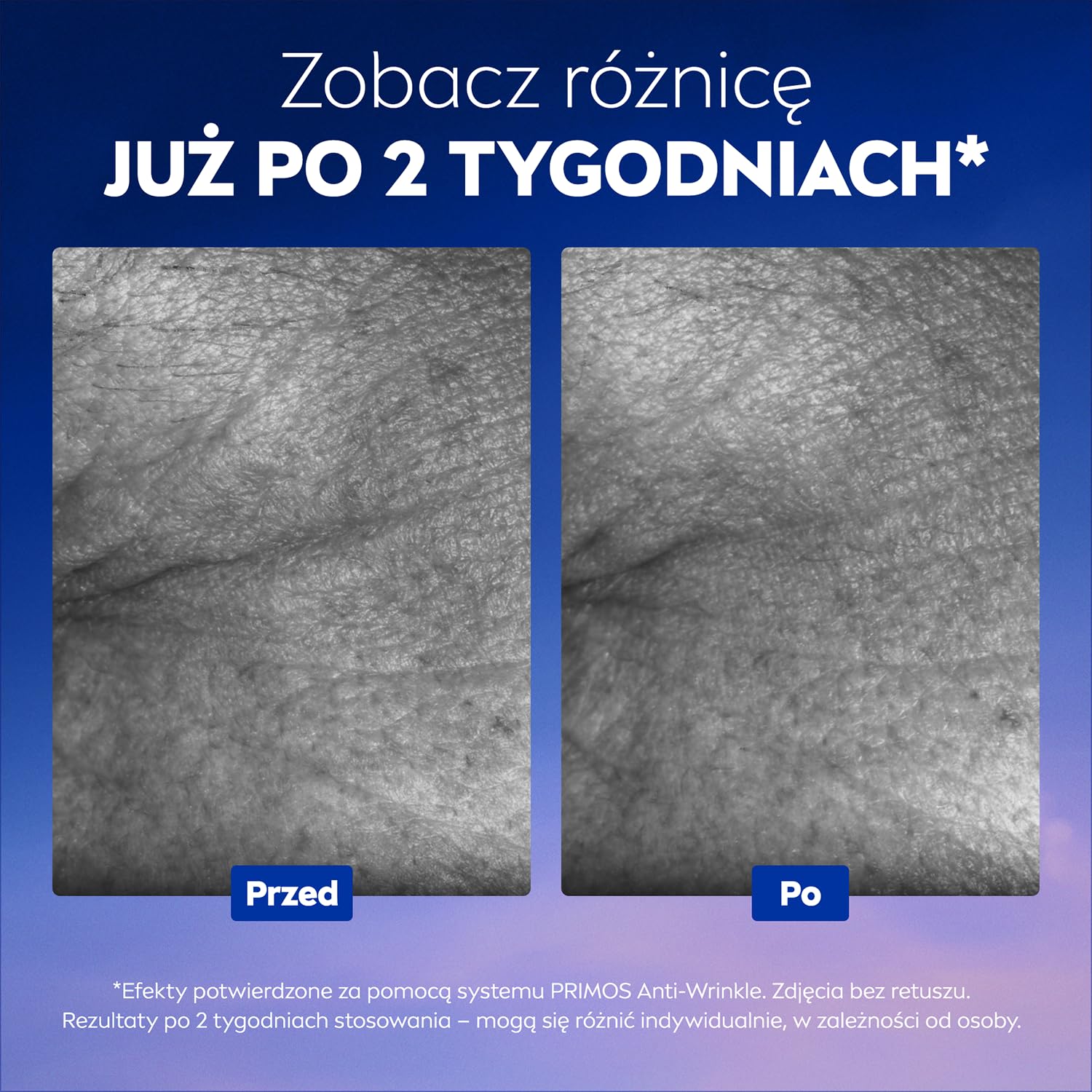 NIVEA CELLULAR Epigenetics Przeciwzmarszczkowe Serum Odmładzające do twarzy na dzień, z kwasem hialuronowym, 15 ml