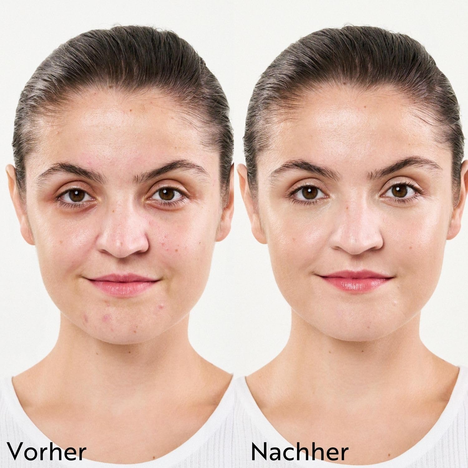 M. Asam CLEAR SKIN Set 4-teilig Anti Pickel Pflege reine Haut Waschgel Toner Maske Creme Porenreiniger Gesichtspflege