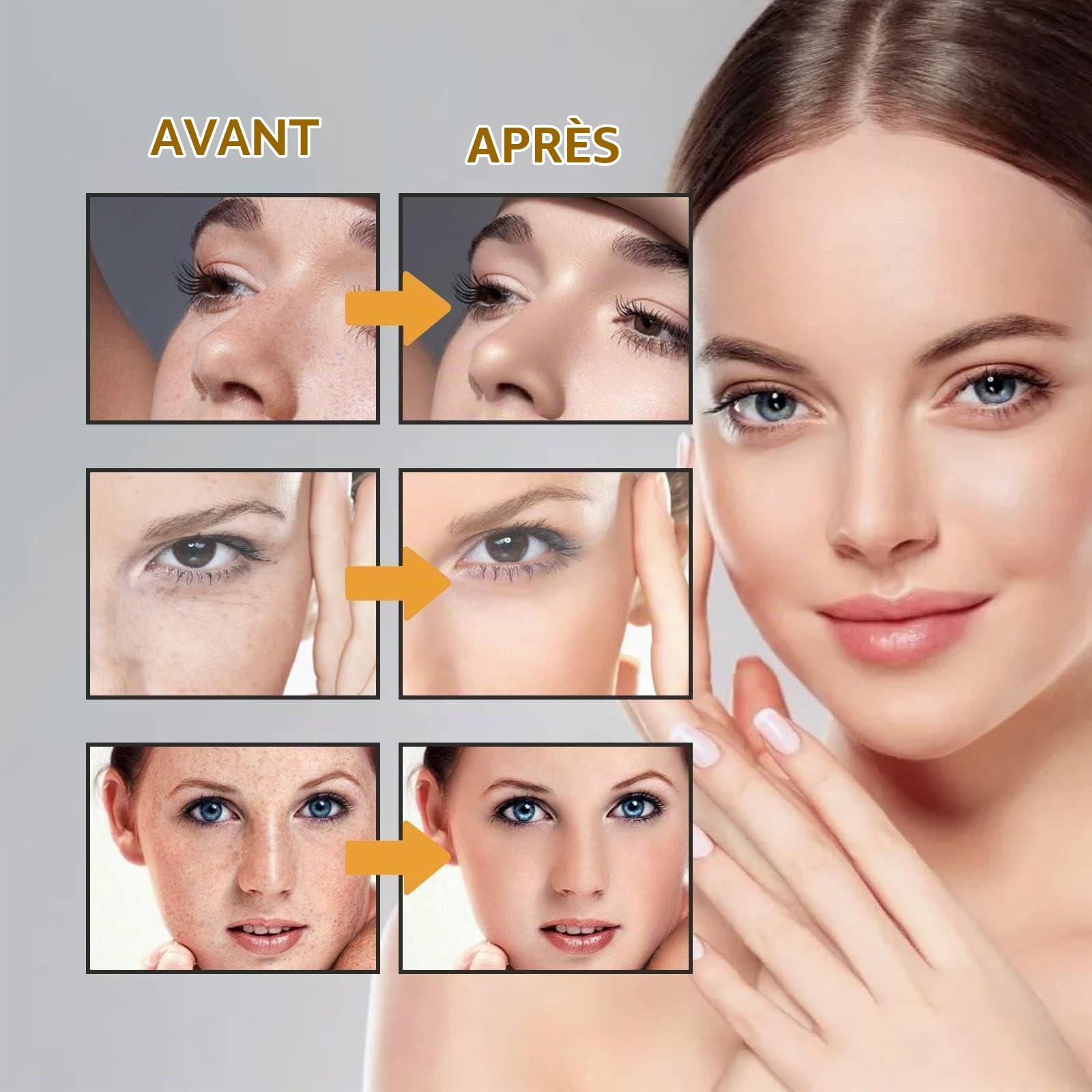 3 Pcs Japanese Melasma Cream, Yunnan Herbal Whitening and Freckle