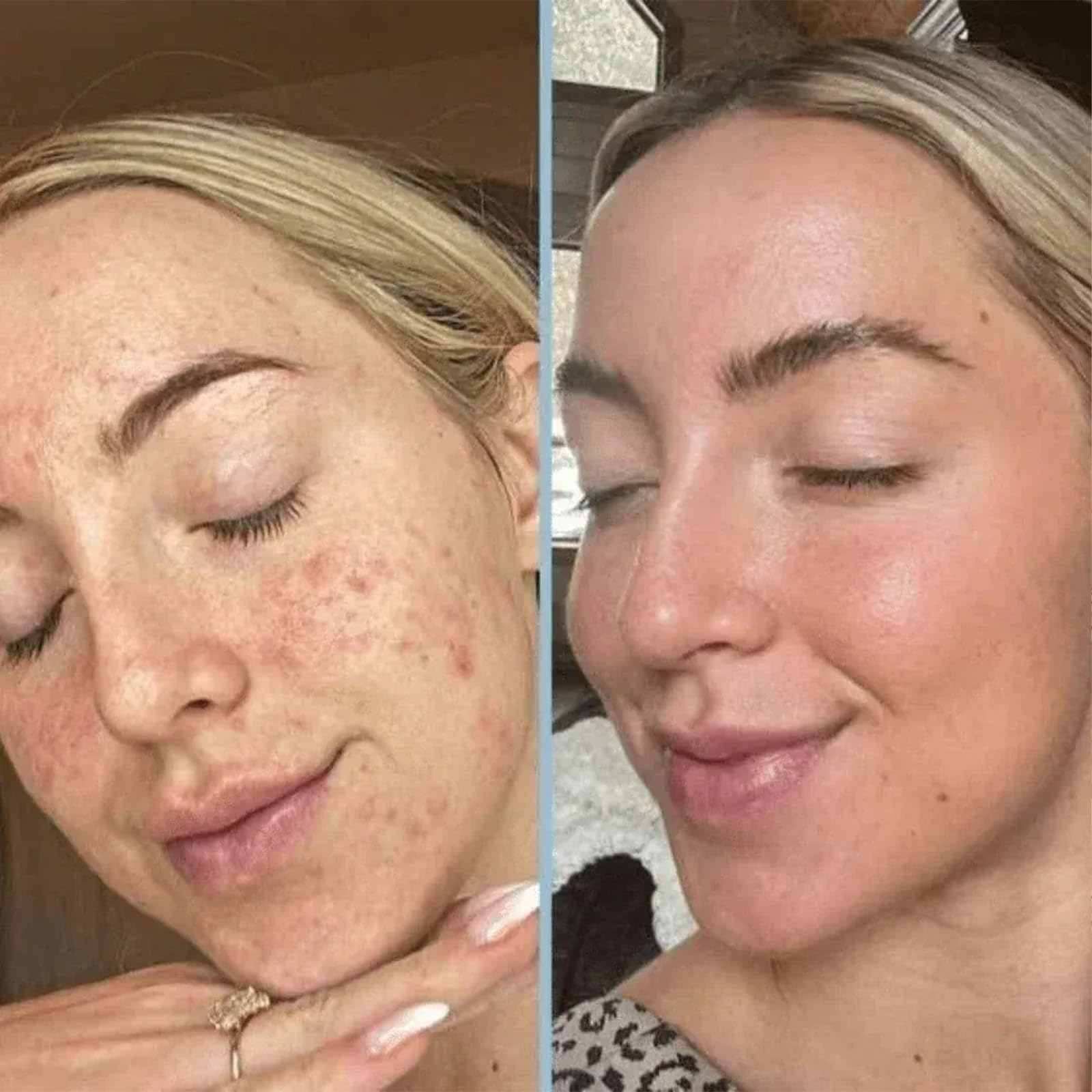 Lumeva Peel Shot Exfoliant Visage Coréen - Sérum Exfoliant Riz Noir & Blanc, Nettoyage Profond des Pores et Points Noirs, Texture Douce, Éclat Immédiat - 80 ml, 2 flacons