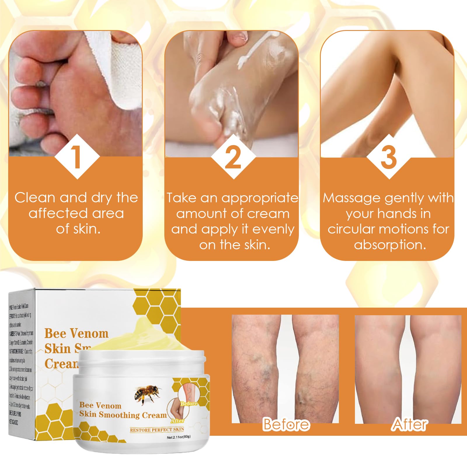 Crème pour Contre les Varices au Venin d'Abeille, Crème de Traitement des Varices au Venin d'abeille, Pommade de Récupération au Venin d'abeille pour les Jambes, Convient à Tous Les Types De Peau, 60g