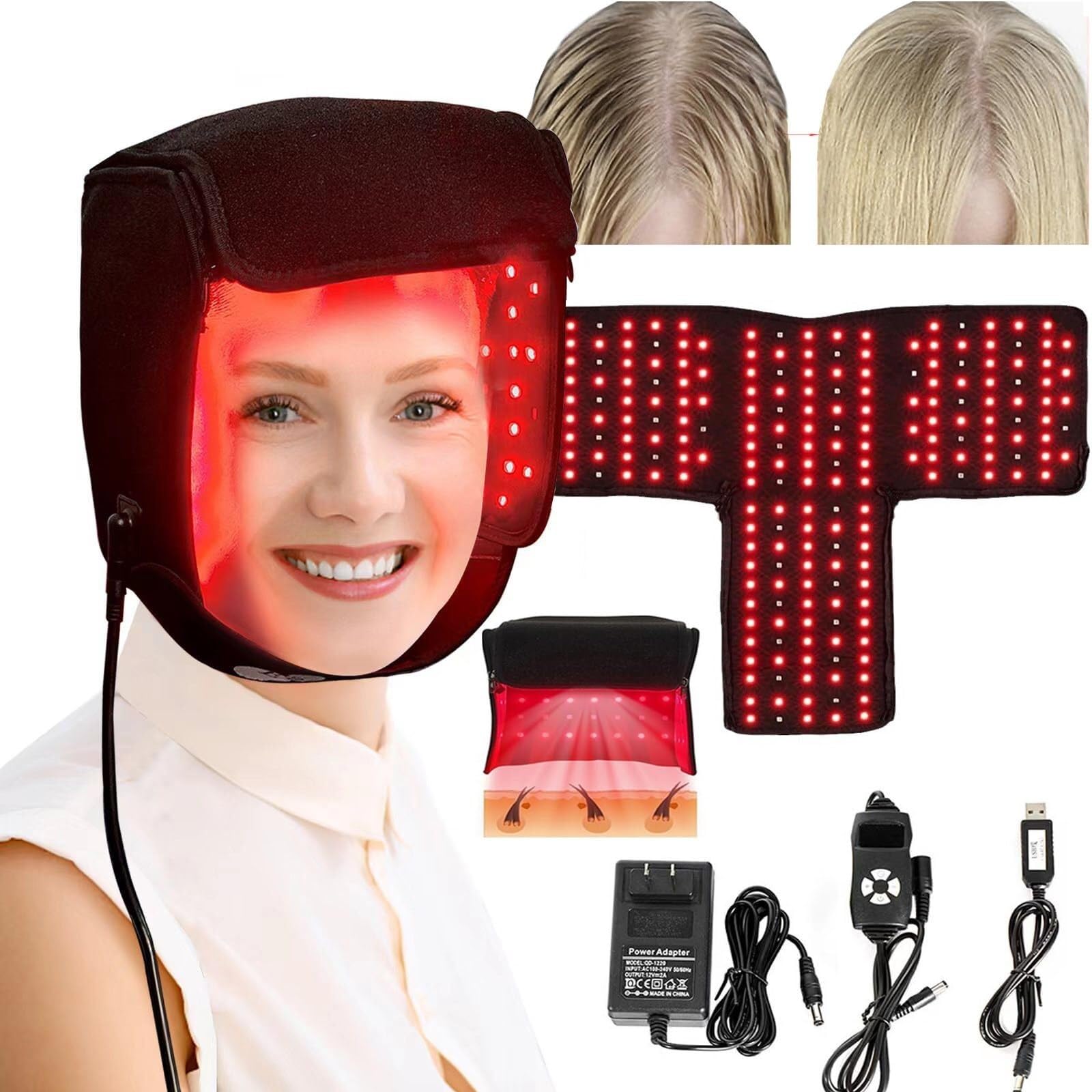Casque repousse cheveux LED 215 pièces traitement perte de cheveux infrarouge
