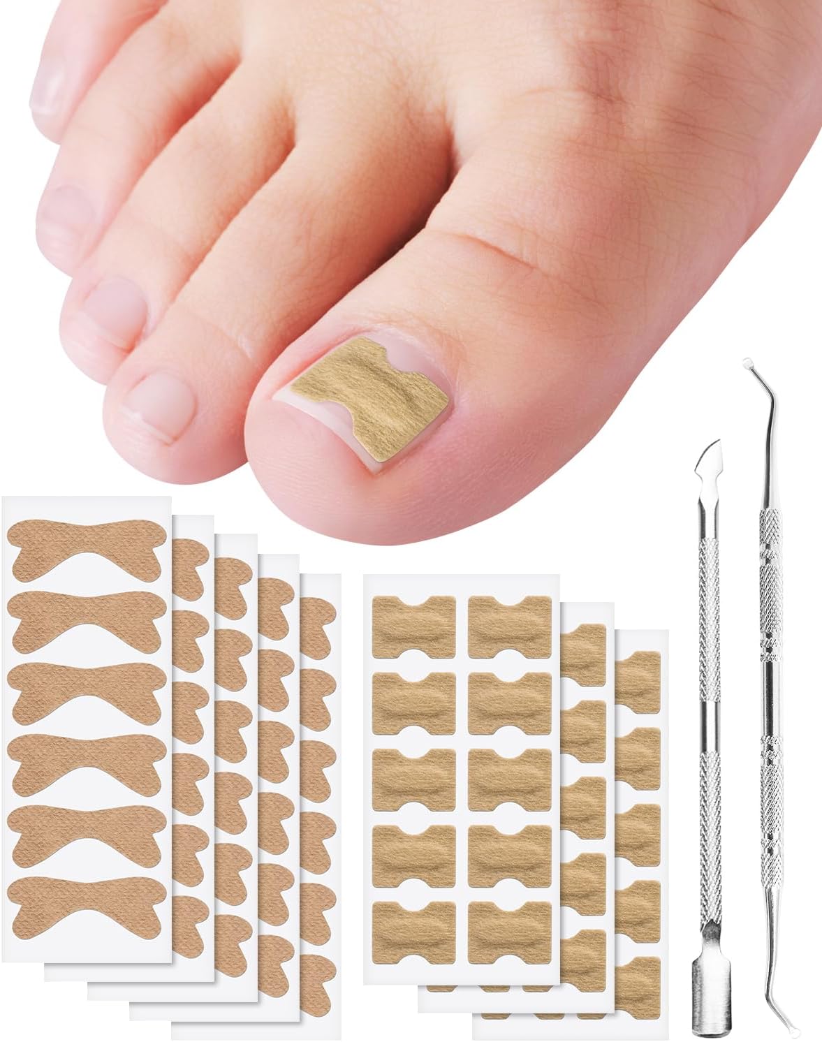 Ingrown Toenail Treatment, Includes 2 Types of 60Pcs Ingrown Toenail