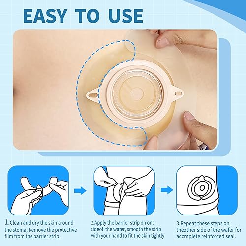 Miniatura 5 de 20 suministros de ostomía, tiras de barrera para ostomía, tiras de cinta adhesiva de barrera elástica para bolsas de colostomía, cinta de ileostomía