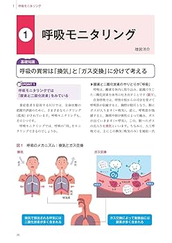 これならわかるICU看護 | 道又元裕 |本 | 通販 | Amazon