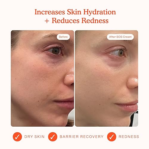 Miniatura 2 de Tower 28 Beauty SOS - Hidratante diario para recuperación de enrojecimiento, barrera cutánea, 1.86 oz  52.73 g