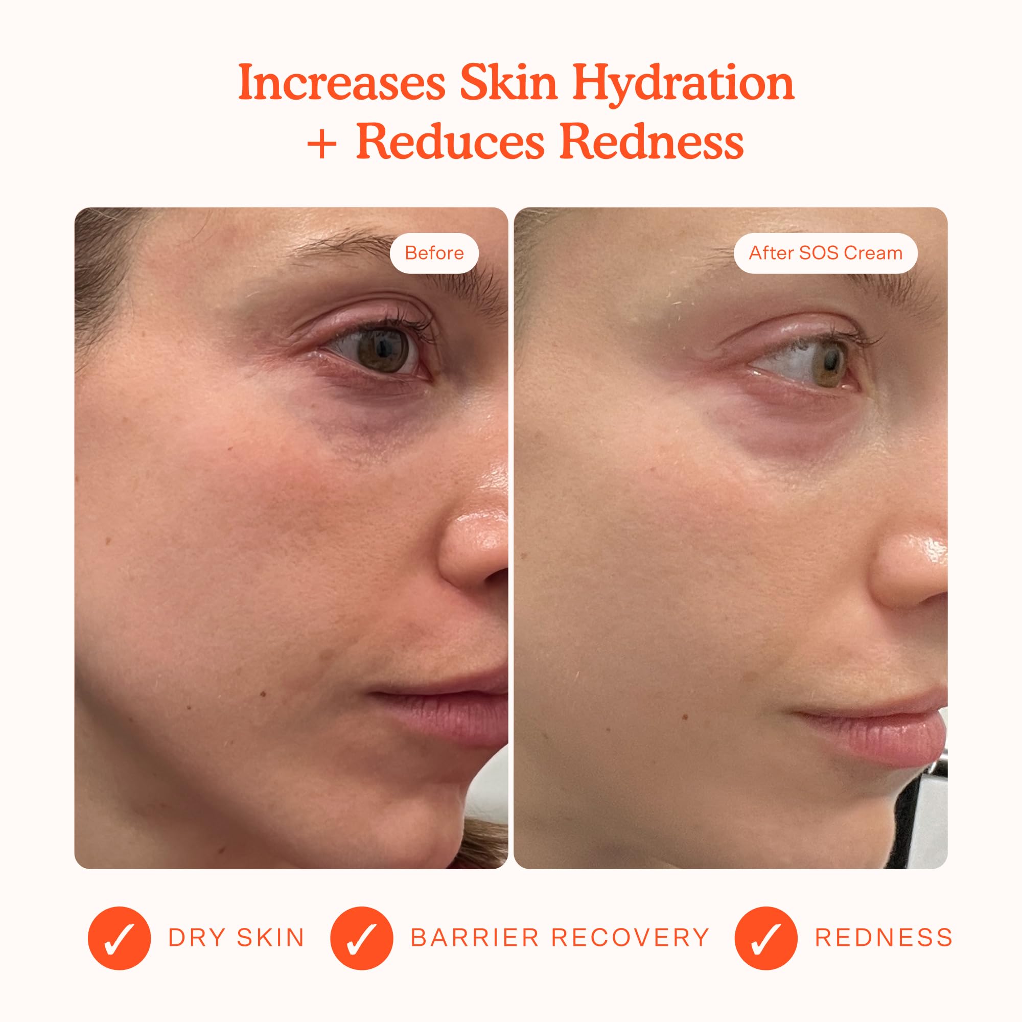 Tower 28 Beauty SOS Daily Skin Barrier Redness Recovery Moisturizer 1.86 oz / 52.73 g