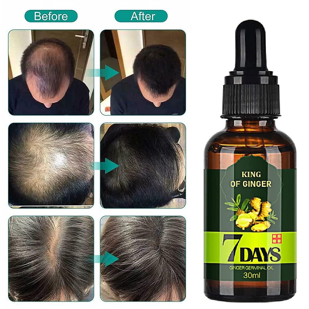 NEW Arrive Hair Regrow 7 Day,Hair follicle regrowth,Ginger Essential