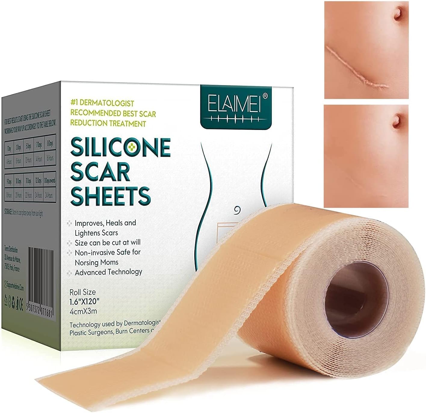 Silicone Scar Sheets,Silicone Scar Tape Roll 1.6”x 120”(8 Month Supply),Soft Silicone Gel Scar Tape,Reusable And Effective Scar Removal Sheets Scar Strips For C-Section & Keloid Surgery, Burn, Acne
