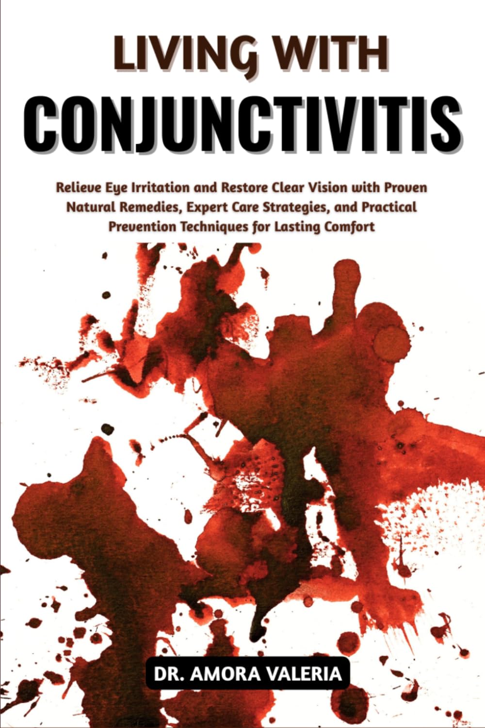 Living With Conjunctivitis: Relieve Eye Irritation and Restore Clear Vision with Proven Natural Remedies, Expert Care Strategies, and Practical Prevention Techniques for Lasting Comfort