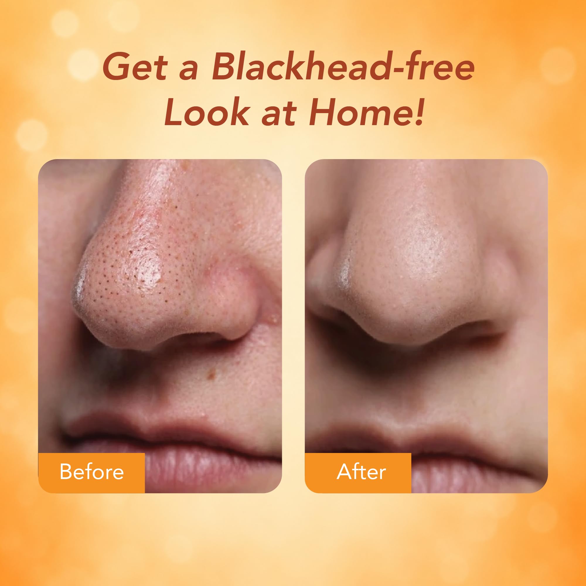 DR.RASHEL Beauty Elixirs Vitamin C Nose Strips with Witch Hazel & Activated Charcoal for Blackhead Removal, Oil Control & Deep Pore Cleansing 10 Strips + 10 Wipes 4