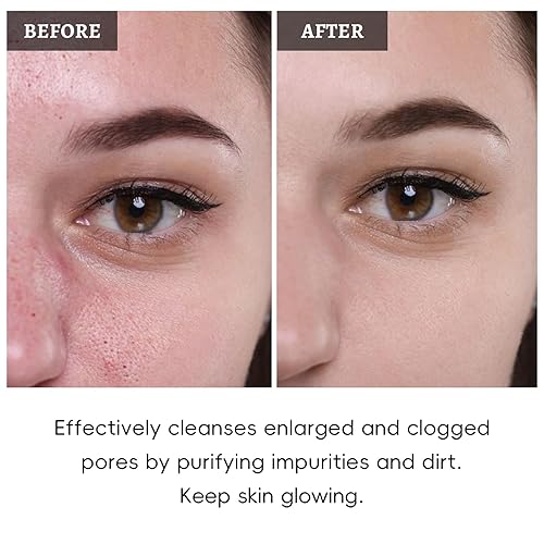 Miniatura 7 de Juego de 4 mascarillas de arcilla, mascarillas faciales para el cuidado de la piel con vitamina C, carbón, artemisa y arcilla morada, regalo de