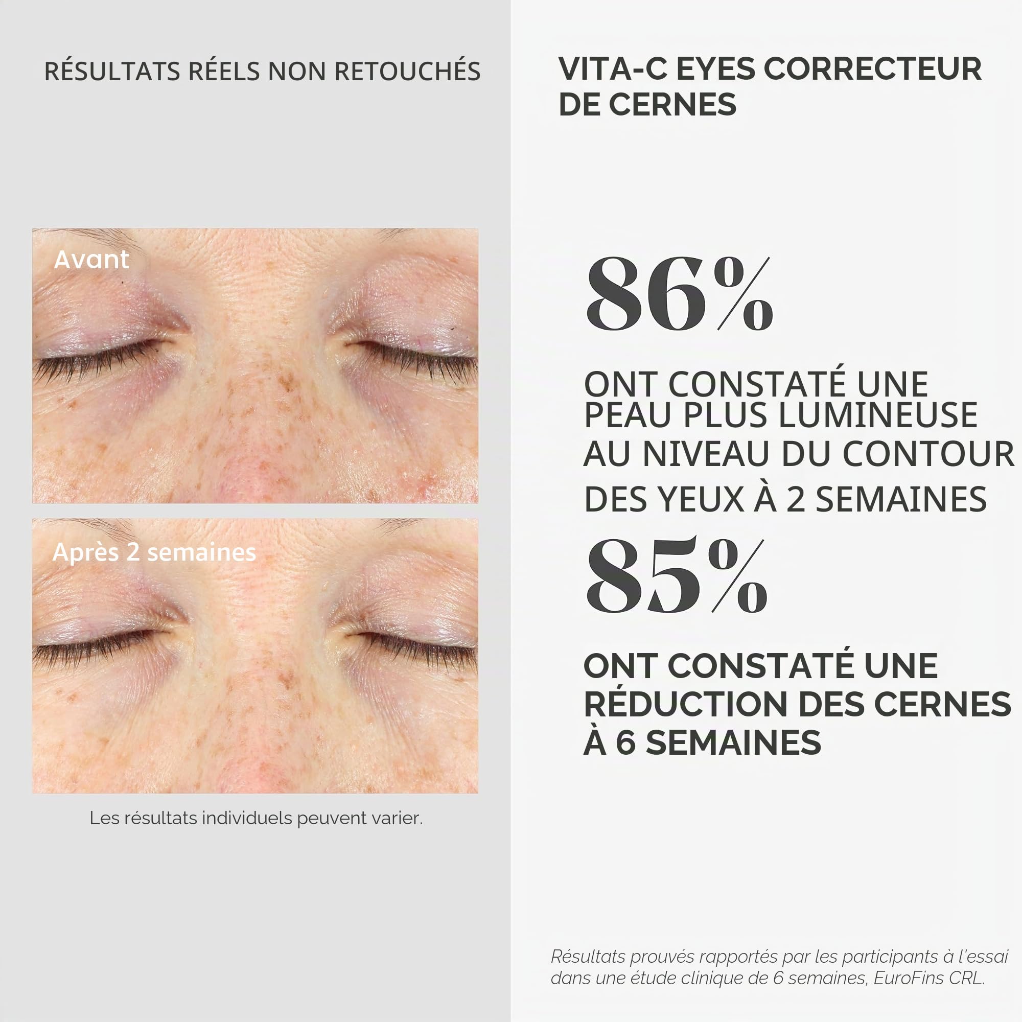 Murad Environmental Shield Vita-C Eyes Sérum correcteur de cernes à la vitamine C, 15 ml, 15272