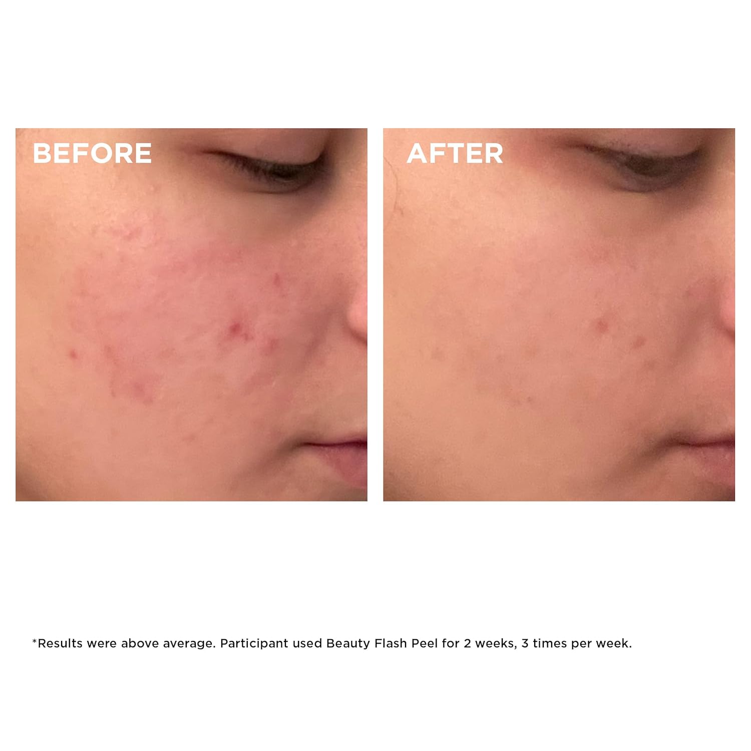 Clarins Beauty Flash Peel | 10-Minute At-Home Facial | Visibly Tightens Pores | Gently Eliminates Dead Skin Cells | Refines Skin Texture | Renews Radiance | Contains AHAs and BHAs | All Skin Types - Image 4