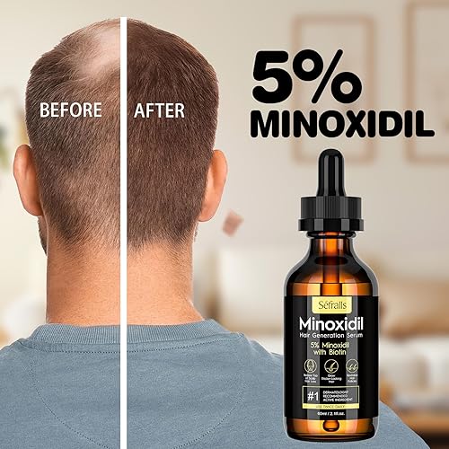 Miniatura 6 de Aceite de crecimiento del cabello de minoxidil al 5% para hombres y mujeres, suero de crecimiento extra fuerte, suero tópico para tratamiento de