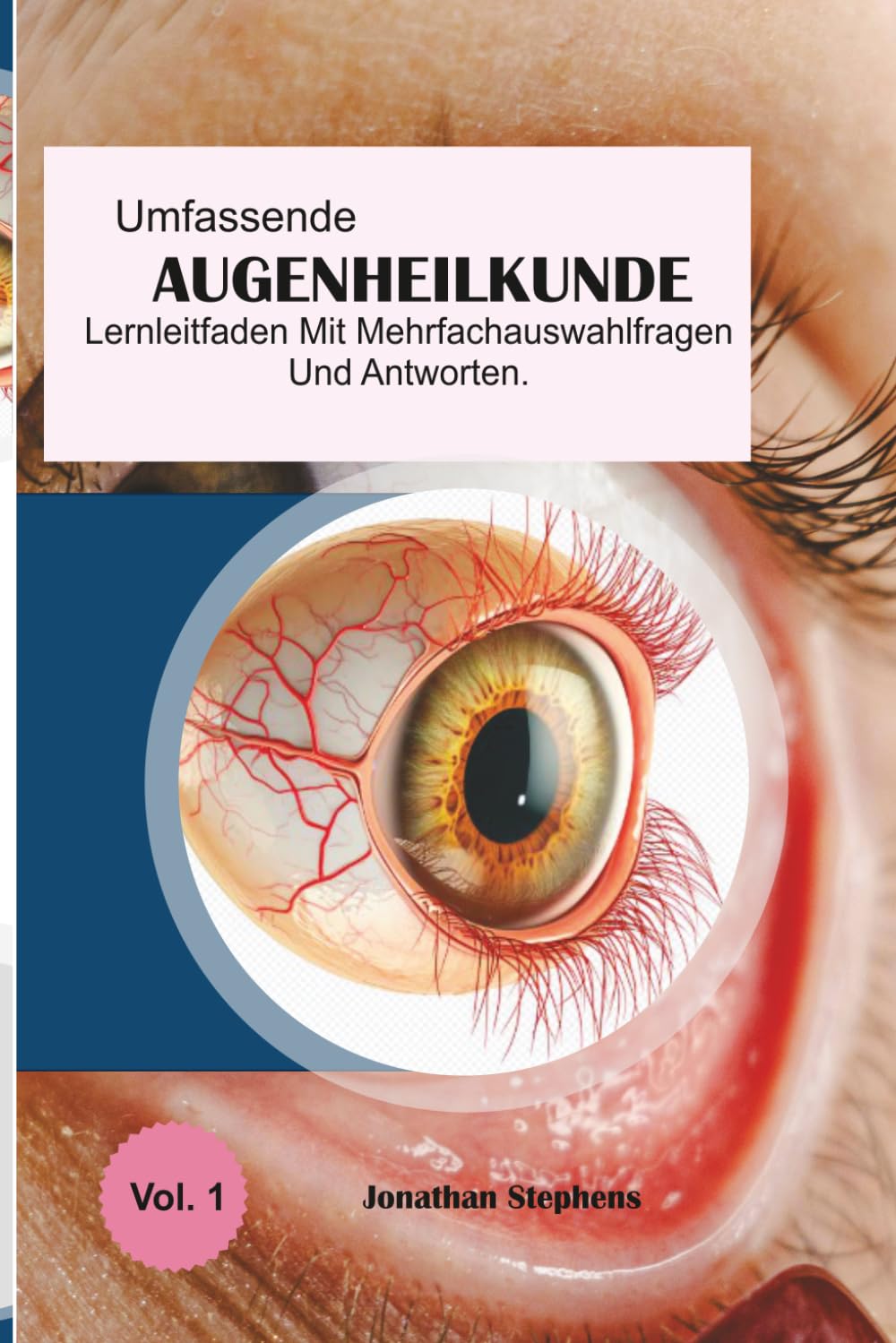 Umfassender Lernleitfaden für Multiple-Choice-Fragen und Antworten zur Augenheilkunde