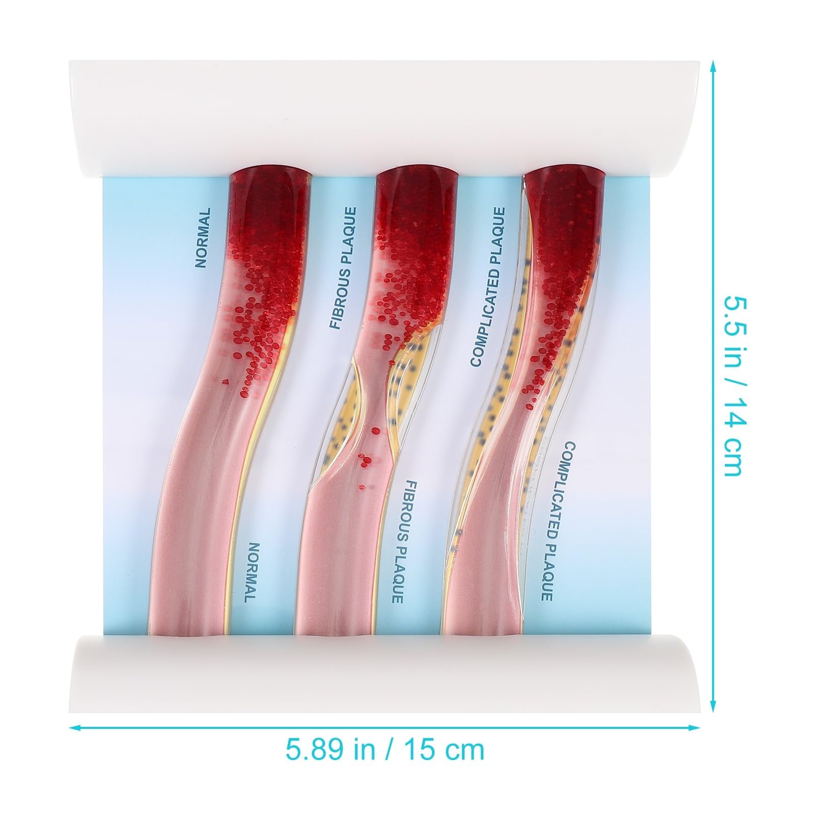MAGICLULU Modelo de Vaso Sanguíneo Didáctico Simulación de Daño por Lipoproteínas de Baja Densidad, Material Duradero para Enseñanza y Prácticas Médicas