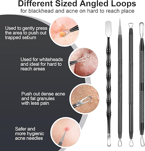 Vista 4 de Juego de herramientas de extracción y extracción de espinillas y acné de acero inoxidable, elimina rápida y de forma segura el acné, puntos negros