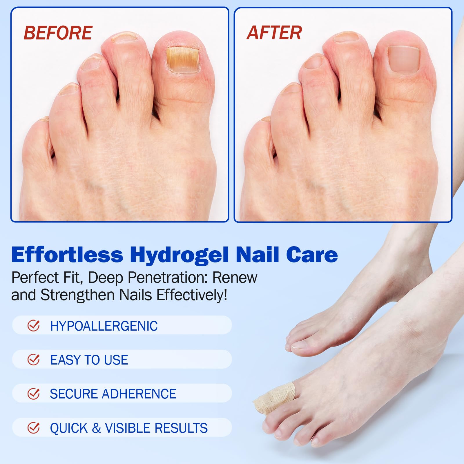 Overnight Hydrogel Toenail Care Patches