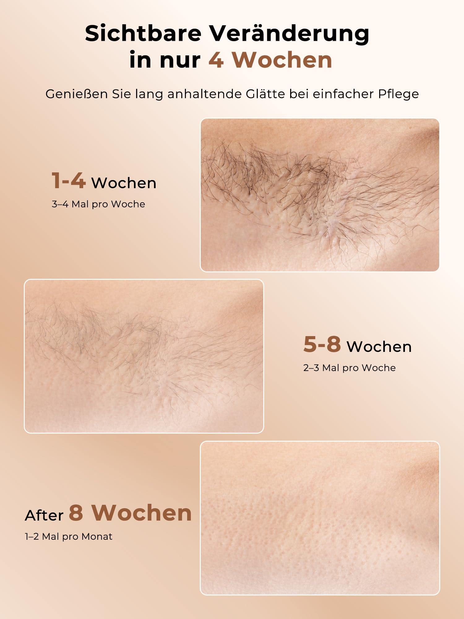 Depiladora Laser con Función de Refrigeración, Depilación Laser con 9 Niveles de Energía Ajustables, 999,900 Flashes, 9 Niveles de Energía, Depiladora Luz Pulsada Para Mujeres, Blanco Dorado
