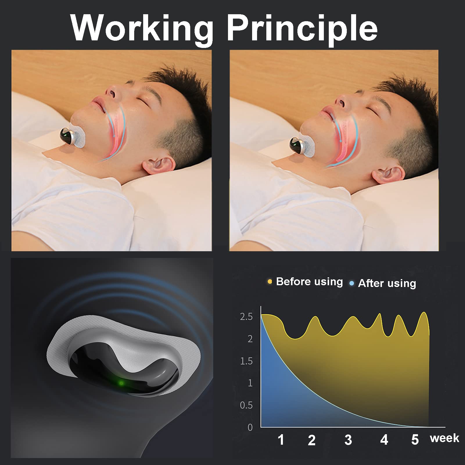 Dispositivo Anti-russamento Intelligente, Dispositivo per Smettere di Russare Mini CPAP, Russare Soluzione per aiutare a dormire,Migliora la Respirazione, 6 livelli di regolazione dell'intensità