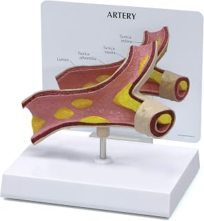 GPI Anatomicals - Artery Model, Replica of an Artery with Cholesterol Deposits for Human Anatomy and Physiology Education, Anatomy Model for Doctor's Office and Classrooms, Medical Learning Resources
