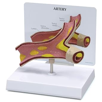 GPI Anatomicals Artery Model with Cholesterol Deposits