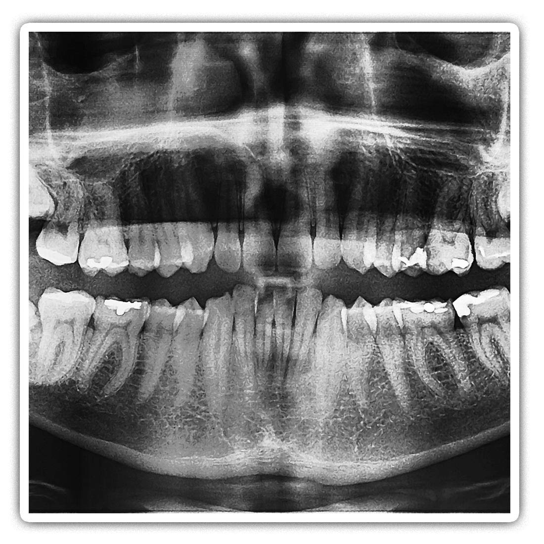 Destination Vinyl Ltd Multi 2 X Square 10Cm Vinyl Stickers - Dental Teeth X-Ray Dentist Dental 42795