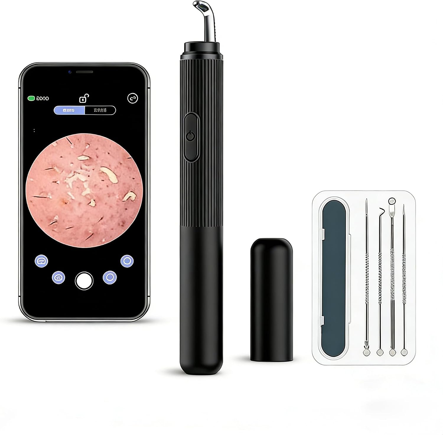 50x HD Visual Blackhead Remover with Camera for Phone - Manual Pimple Extractor Tool with LED Light & USB-C Rechargeable Comedone Extractor for Face Nose – Clear Skin Care Kit (Black)