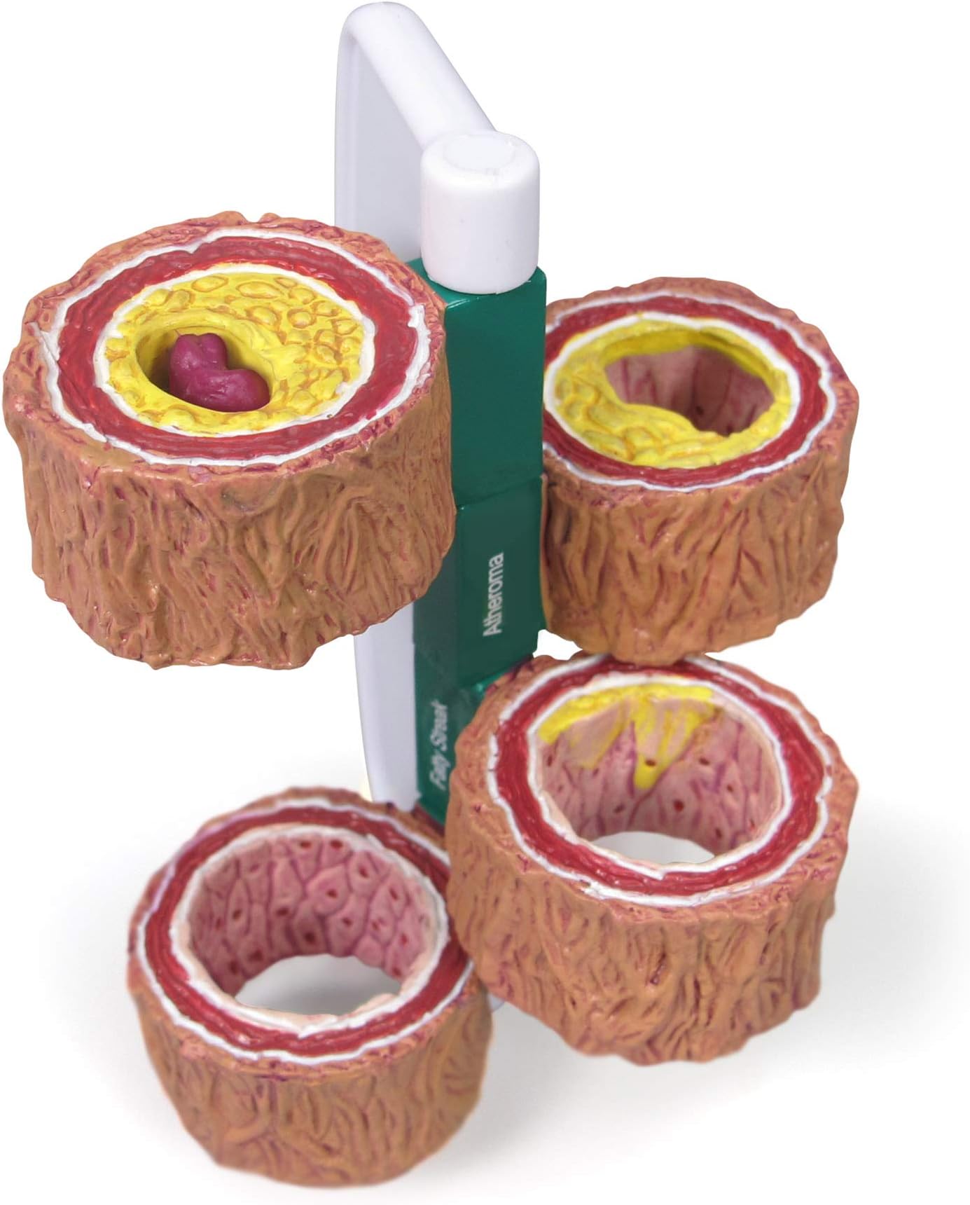 GPI Anatomicals - 4-Piece Artery Model, Replica of an Artery with Plaque for Human Anatomy and Physiology Education, Anatomy Model for Doctor's Offices and Classrooms, Medical Learning Resources