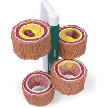 GPI Anatomicals 4-Piece Artery Model, Replica of an Artery with Plaque | Human Body and Anatomy Replica for Physiology Education, Anatomical Model for Doctors Office, Medical Learning Resources