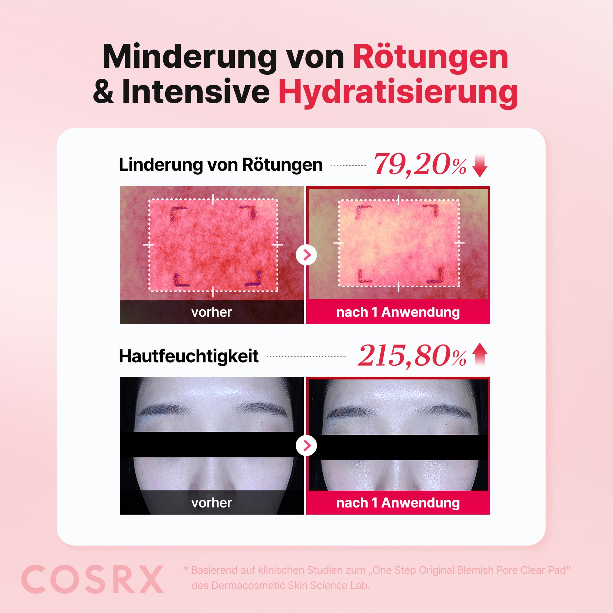 COSRX OneStep Original Blemish Pore Clear Pad, 100 Pads, Dual-Sided Facial Pad for Exfoliation, Pore Care & Hydration with BHA, PHA & Zinc PCA & 5 Hyaluronic Acids, Korean Skin Care