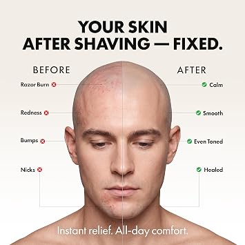 Aberlite Aftershave Balm for Men Soothes Razor Burn, Reduces Redness & Prevents Bumps Head & Face Formula Heals Nicks & Cuts 5 FL OZ