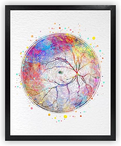 24 x 36 vasos retinianos sin marco arteria ojo humano anatomía optometrista arte médico oftalmología vasos sanguíneos clínica arte de pared acuarela
