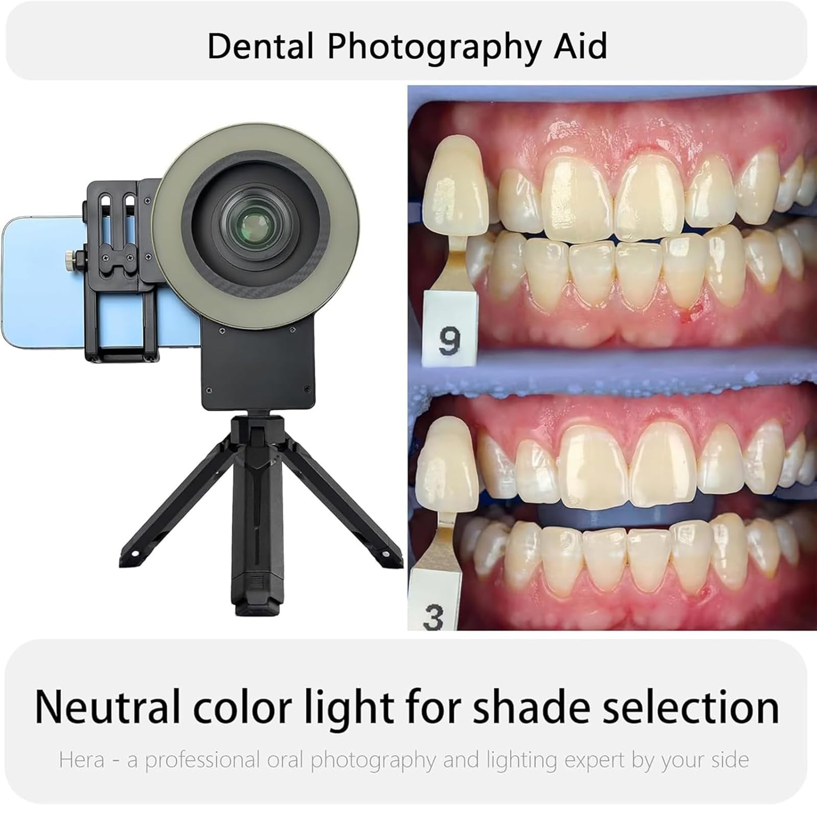 Luz LED De Relleno Bucal Para Odontología, Luz De Relleno Para Cámara De Teléfono Móvil Con Filtro De 49 Mm Y Lente Macro De 100 Mm, Temperatura De Color De 2500 K a 6000 K, Para Salón En Casa.