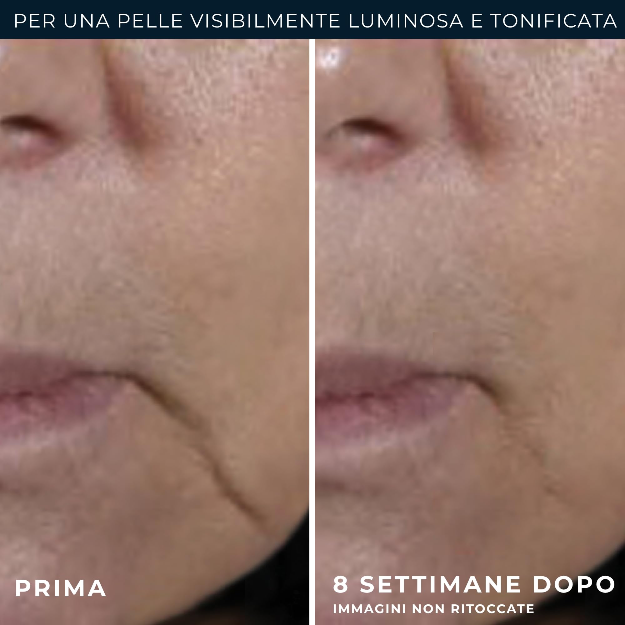 RoC - Multi Correxion Anti-Rilassamento Firm + Lift Crema Viso - Antirughe e Antietà - Migliora la Compattezza - Effetto Lifting Cosmetico - 50 ml