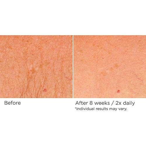 Miniatura 4 de NassifMD Deco-Lift Complejo reafirmante y lifting de cuello y escote