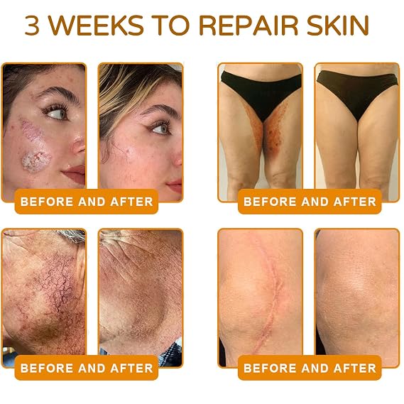 Bee Venom Skin Treatment Cream, Advanced Firming & Wrinkle-Reducing cream, Bee Venom Skin Restoration Cream, Natural Serum Suitable for All Skin Types (2 Pack)