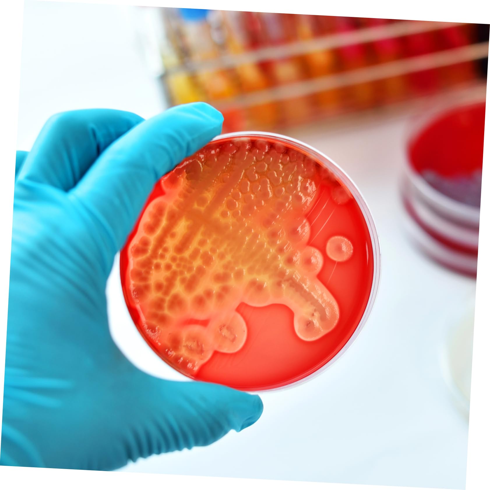 Piastre di Petri con Agar Nutriente 20 Pezzi, Piastre