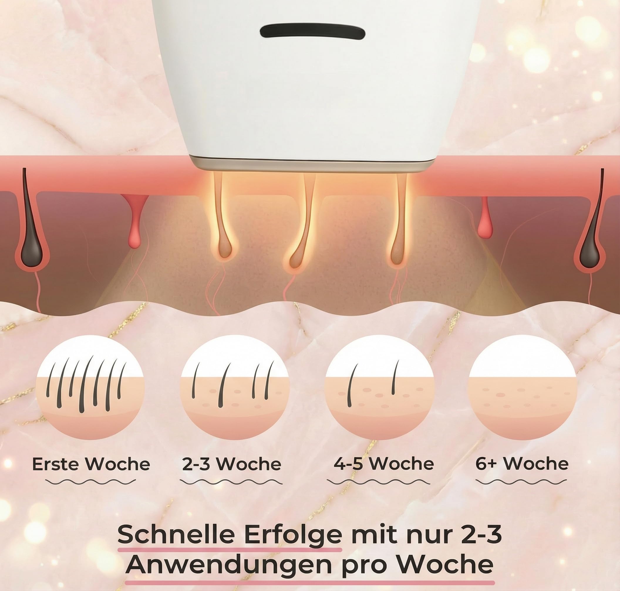 Loop Von Solippy-Effektives IPL Gerät zur dauerhaften Haarentfernung für Frauen und Männer – Ideal für Beine, Arme und Gesicht (Weiß 470nm-1100nm)