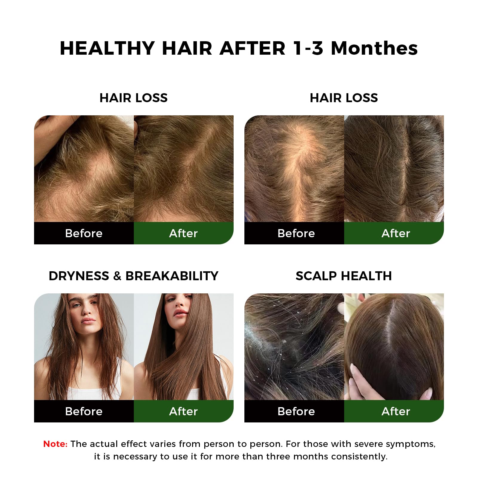 OUKEYA Raw Batana Oil Hair Mask for Hair Growth 100% Natural Organic from Honduras, Boosts Hair Thickness & Strength - Image 4
