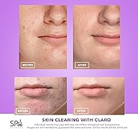 Vista 6 de Spa Sciences CLARO - Sistema de terapia de luz LED azul y rojo clínicamente probado para el acné FDA Cleared-Rechargeable - Tratamiento profesional