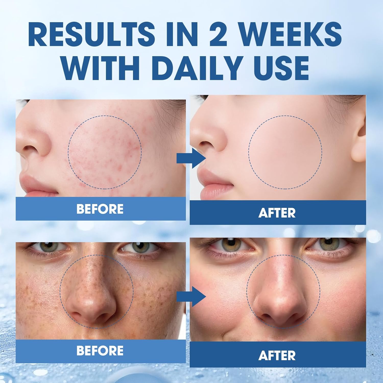 Salmon DNA PDRN Peptide Serum – Hydrating, Firming & Brightening, Uneven Skin Tone, 1.01 fl.oz. - Image 3