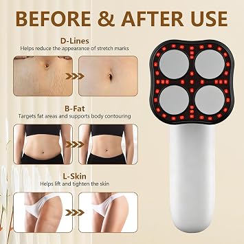 Cellulite Massager Tool, Body Sculpting Machine with Heating & Microcurrent