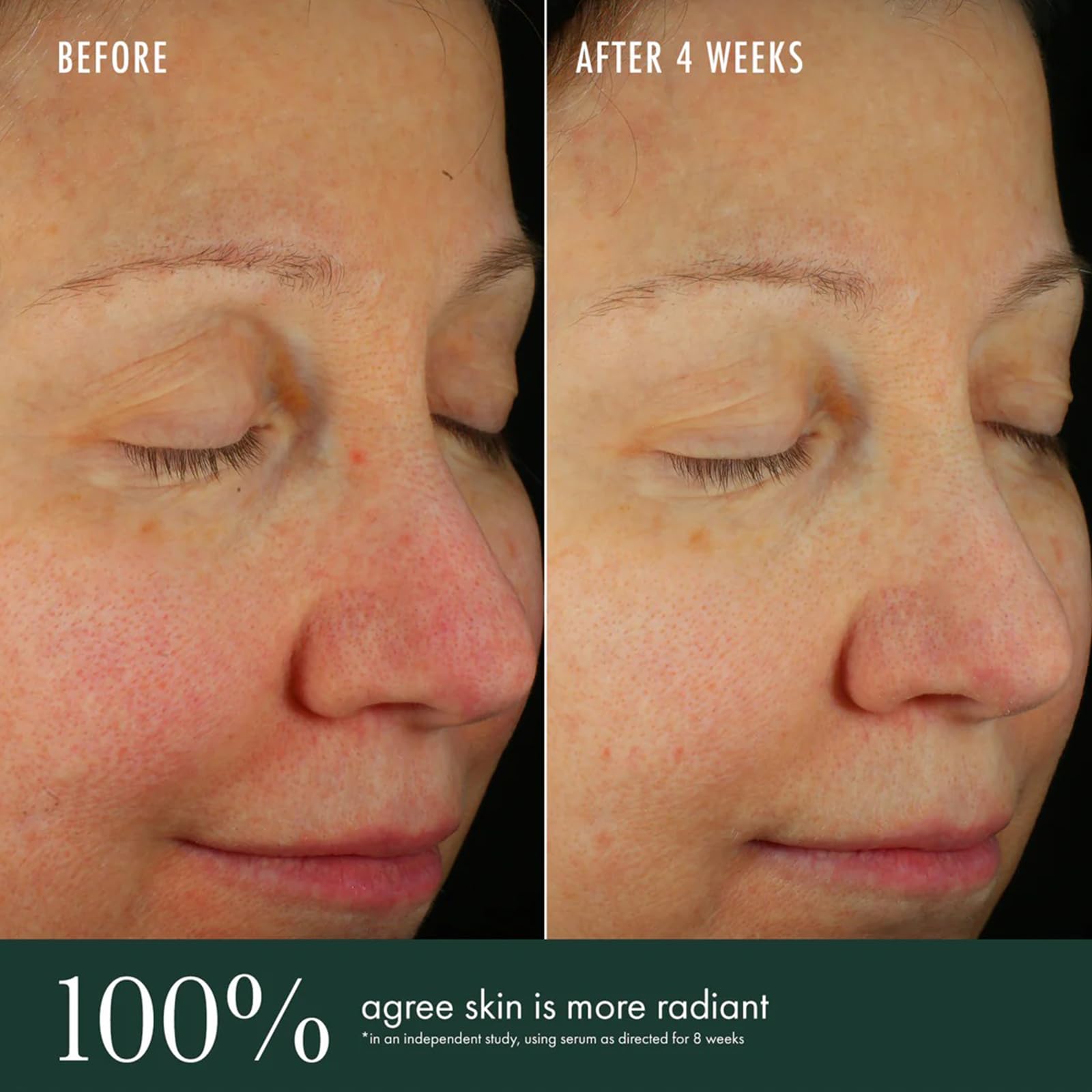 RéVive Brightening Serum - Skincare with Vitamin C, Niacinamide and Bio-Renewal Peptide - Evens Skin Tone, Refines Skin Texture and Reduces Wrinkles