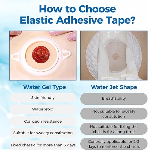 Miniatura 5 de 20 tiras elásticas de barrera para ostomía, hidrocoloide de grado médico, suministros de ostomía, cinta adhesiva para la piel, fugas impermeables