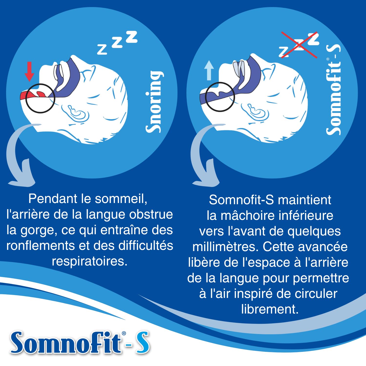 S - Orthèse Anti-Ronflement - Gouttière Dentaire Flexible et Thermoformable - Design Breveté, Grand Confort - Orthèse Mandibulaire Fabriquée en Suisse